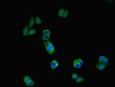 IL17RA antibody