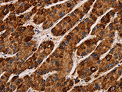 IL17RA Antibody