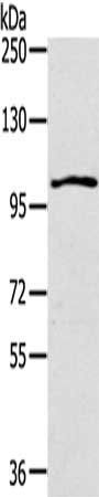 IL17RA antibody