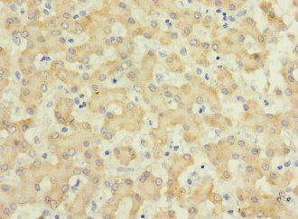IL17RB Antibody