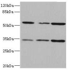 IL17RB antibody