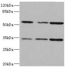 IL17RB Antibody