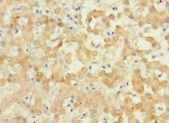 IL17RB Antibody