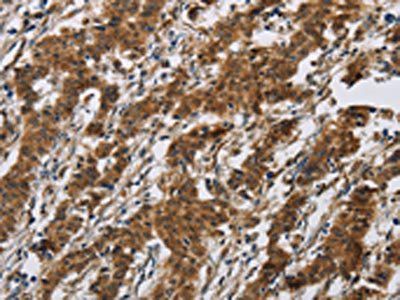 IL17RB Antibody