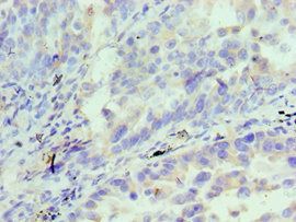 IL18RAP Antibody