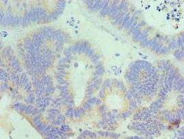 IL18RAP Antibody