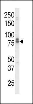 IL18RAP antibody