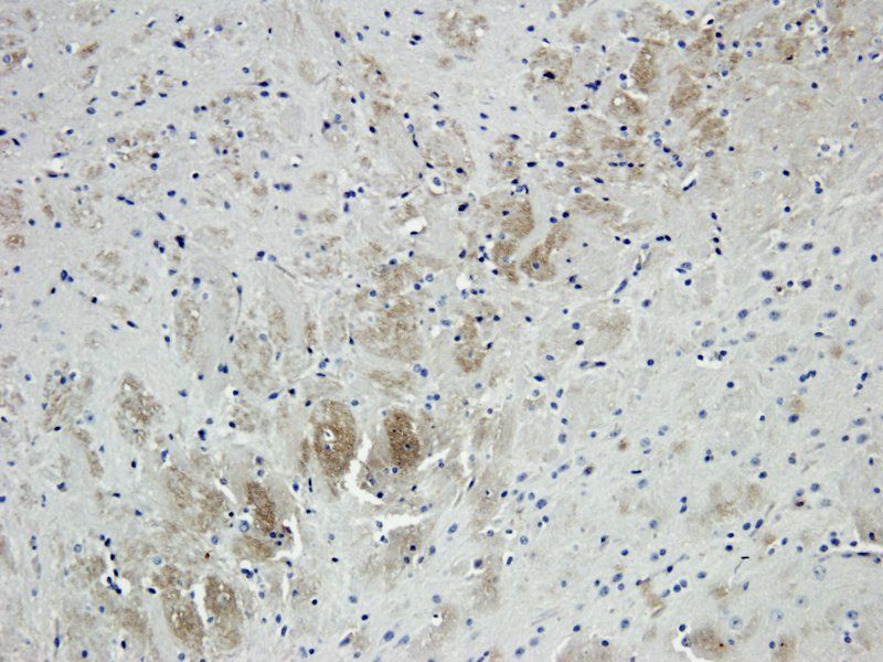 IL1 alpha antibody