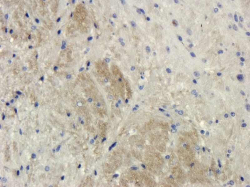 IL1 alpha antibody