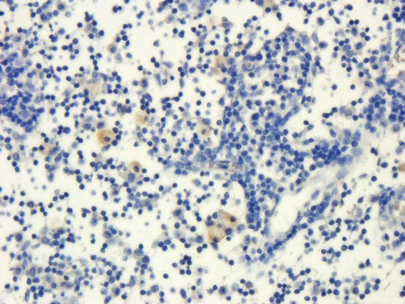 IL1 alpha antibody