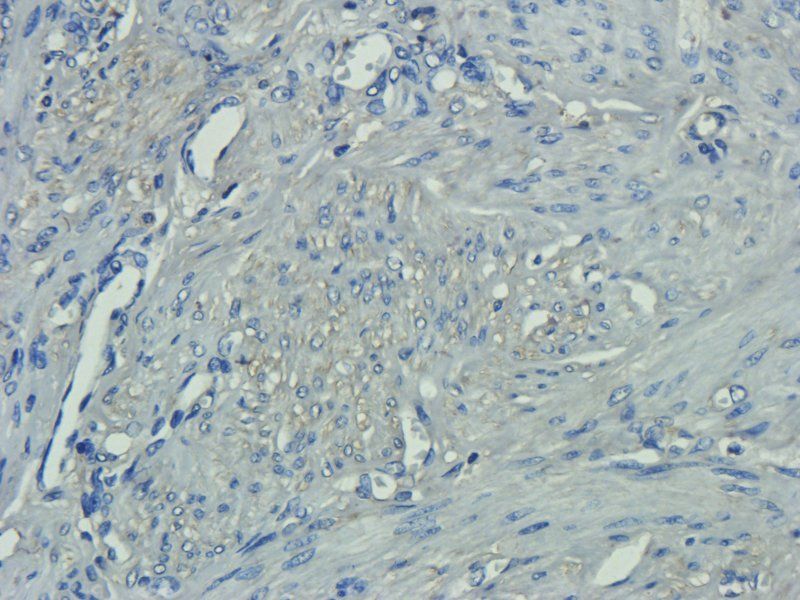 IL1 alpha antibody