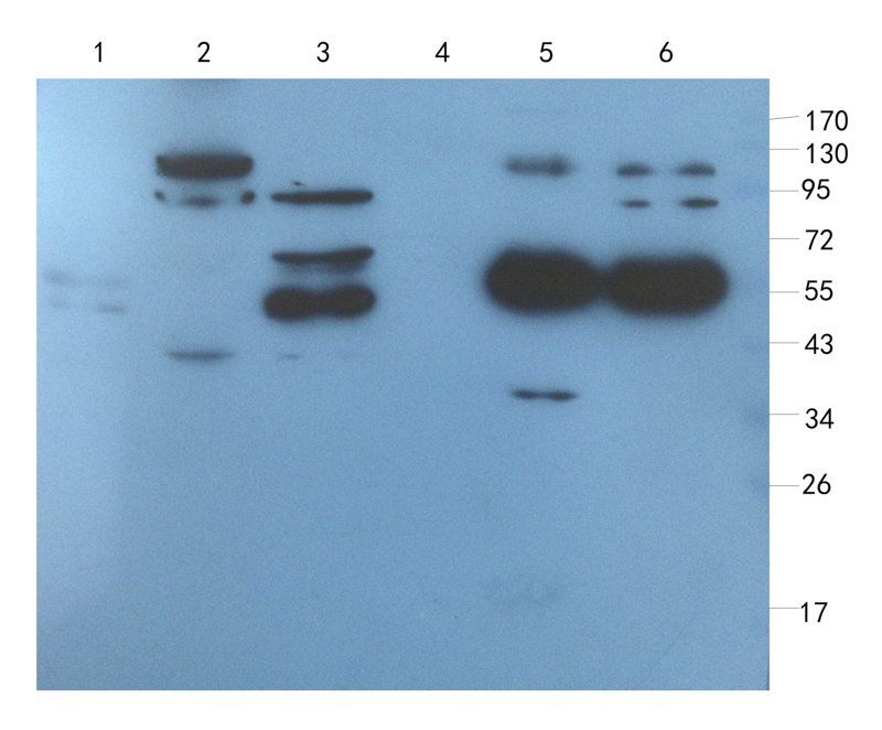 IL1 alpha antibody