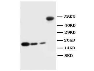 Anti-IL1 beta/IL1B Antibody