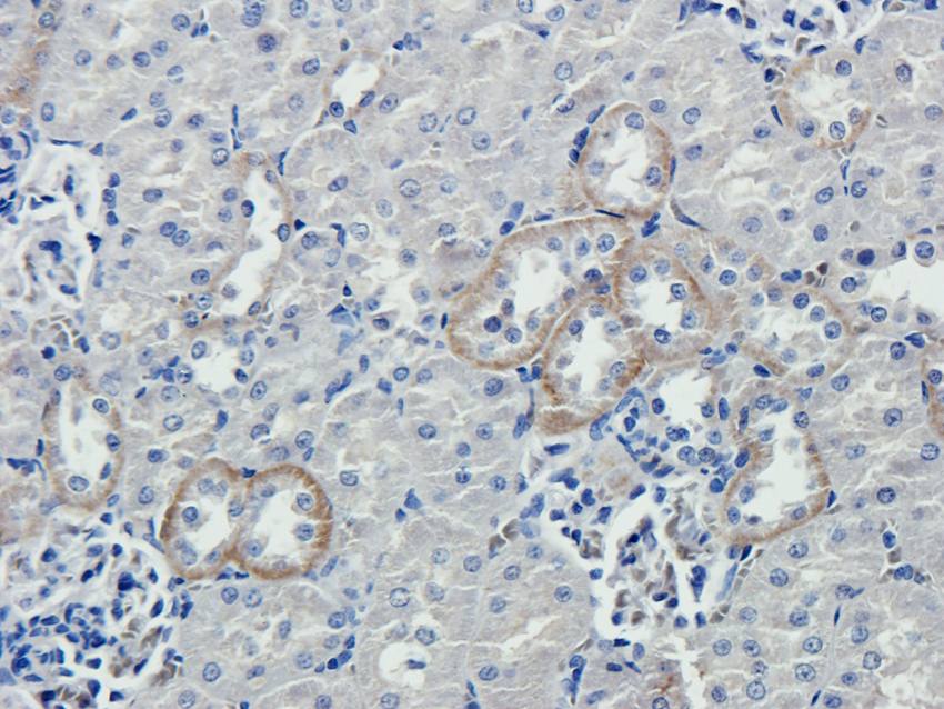 IL1 beta antibody