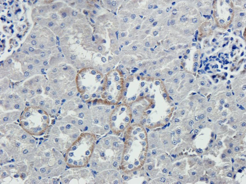 IL1 beta antibody