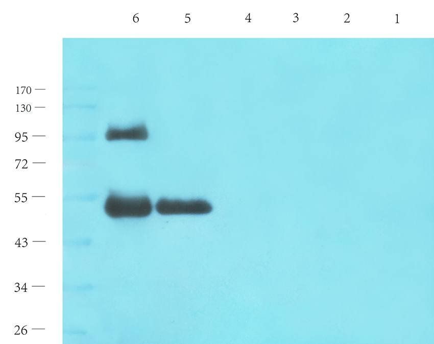 IL1 beta antibody