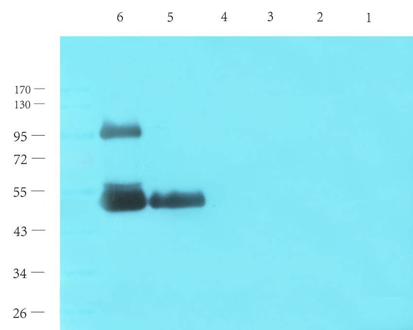 IL1 beta antibody