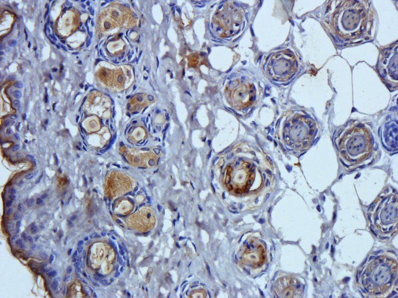IL1RA antibody
