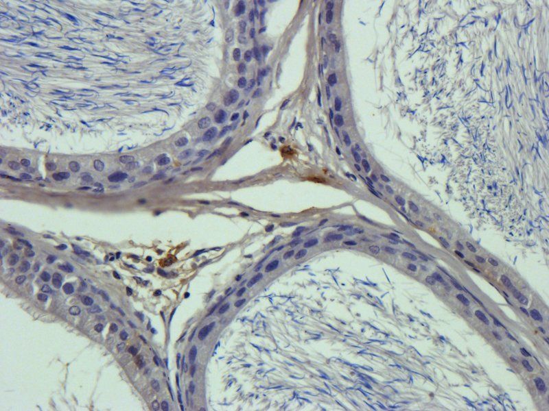 IL1RA antibody