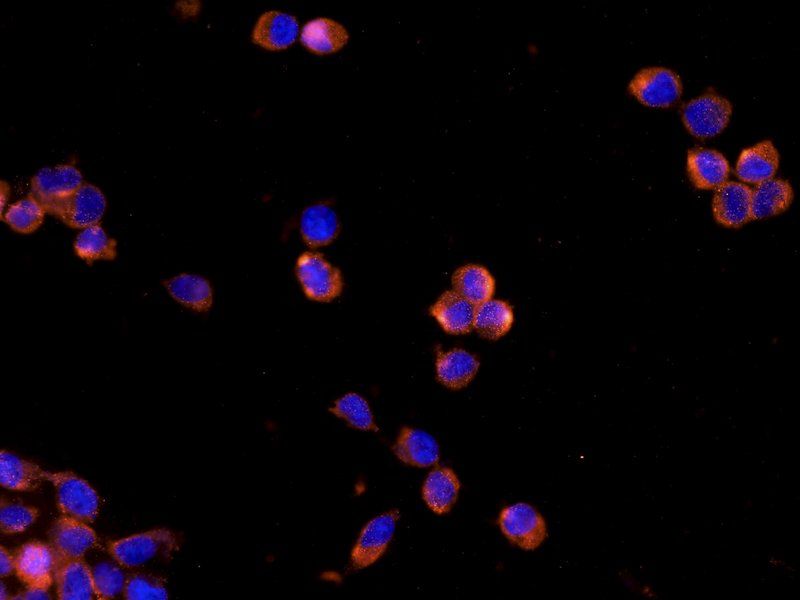 IL1RA antibody