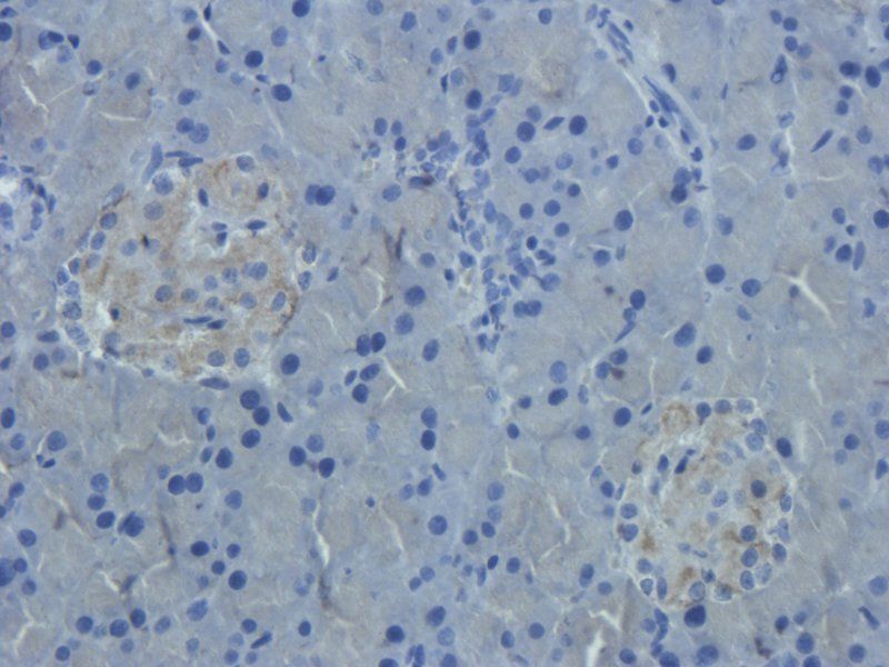 IL1 RA antibody