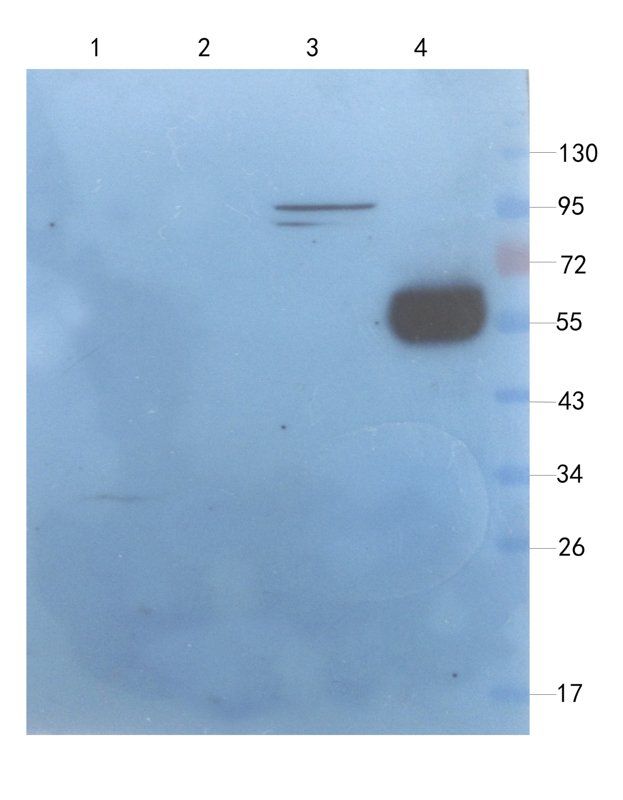 IL1 RA antibody