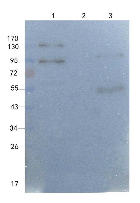 IL1 RA antibody