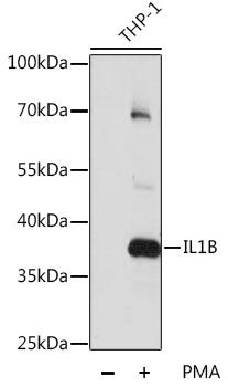 IL1B antibody