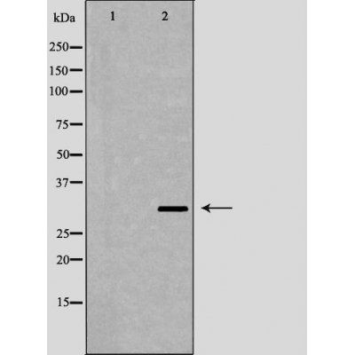 IL1 beta Antibody