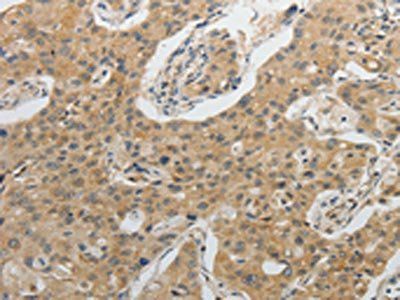 IL1B Antibody