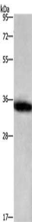 IL1B antibody