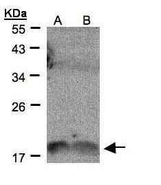 IL1F9 Rabbit Polyclonal Antibody