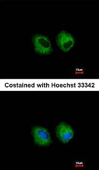 IL1R2 antibody