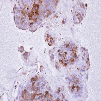 IL1R2 antibody