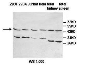 IL1R2 Rabbit Polyclonal Antibody