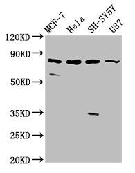 IL1RAPL1 antibody