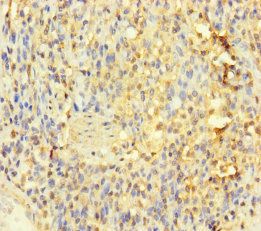 IL1RL2 Antibody