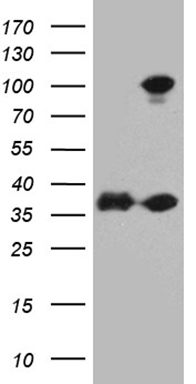 IL2 Antibody