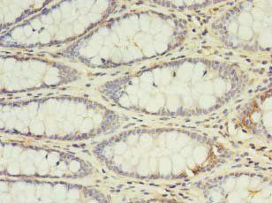IL2 Antibody