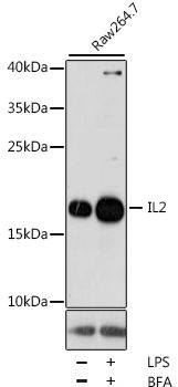 IL2 antibody