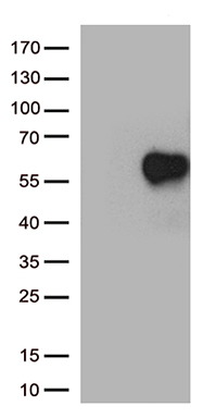 IL2RA Antibody