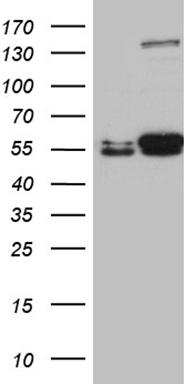 IL2 Receptor alpha Antibody