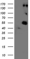IL2 Receptor alpha Antibody