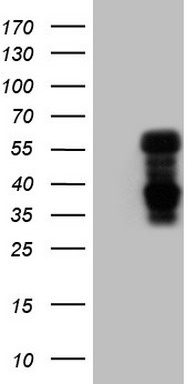 IL20 Antibody