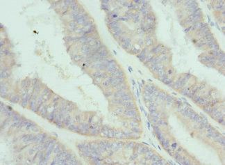 IL20 Antibody