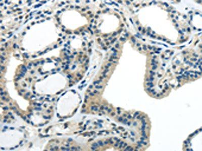 IL20 Antibody
