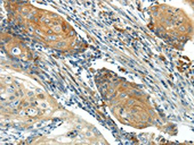 IL20 Antibody