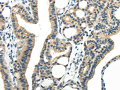 IL20 Antibody