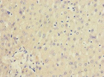 IL20RA Antibody