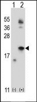 IL21 antibody